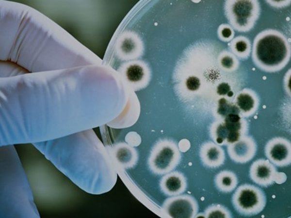 a hand holding a petri dish with white and green mold